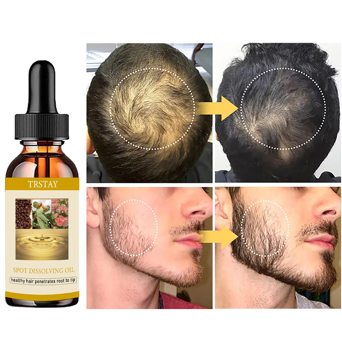 50ML Olejek na porost brody Pr – Beard Oil Growth recenzja i cena